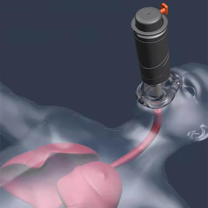 Anti Choking Device